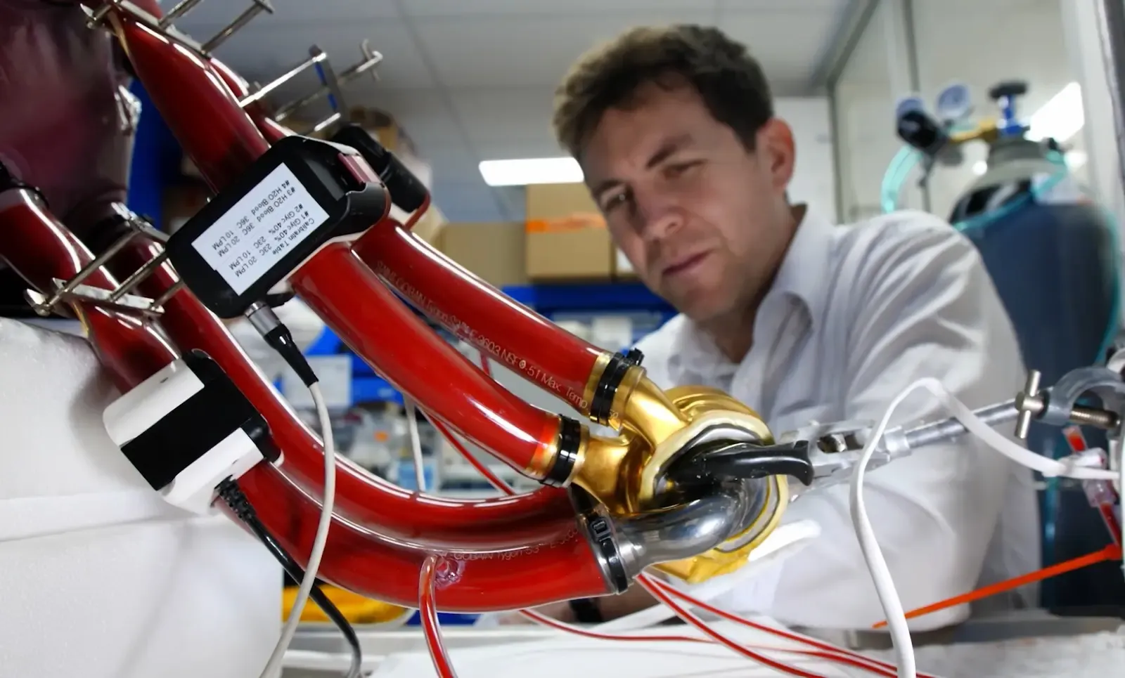 Australian Man Achieves Milestone with Durable Artificial Heart for Over 100 Days