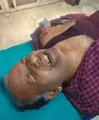 Businessman Injured in Ranchi Shooting, Suspects Flee