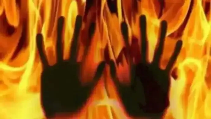 Differently-abled Individual Tragically Dies in MP Fire