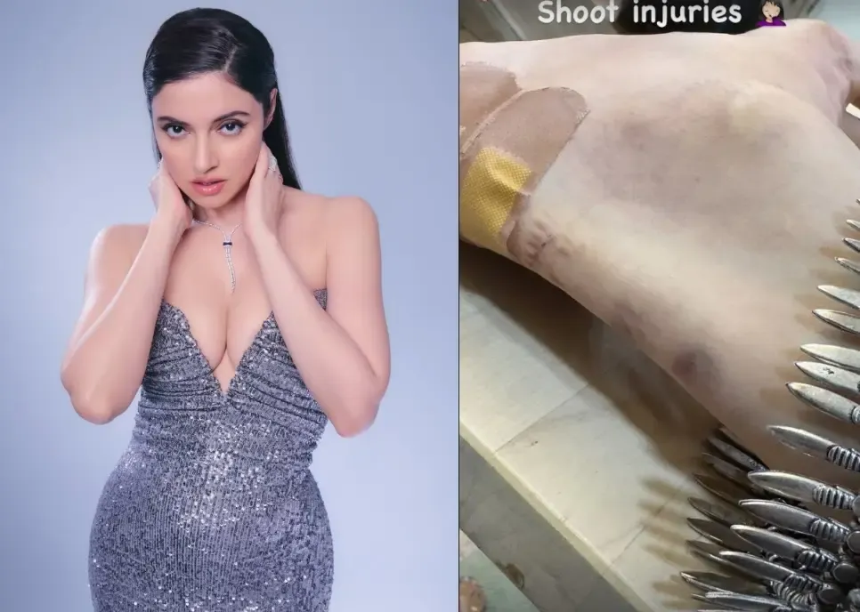 Divya Khossla Injured on Set While Filming New Movie