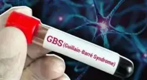 GBS Epidemic: Central Government Urges Maharashtra to Intensify Surveillance and Implement Appropriate Actions