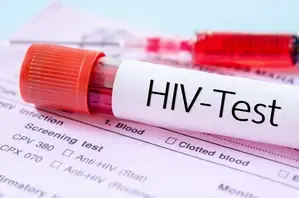 Global HIV Diagnosed Cases Expected to Exceed 2.2 Million by 2033: New Report
