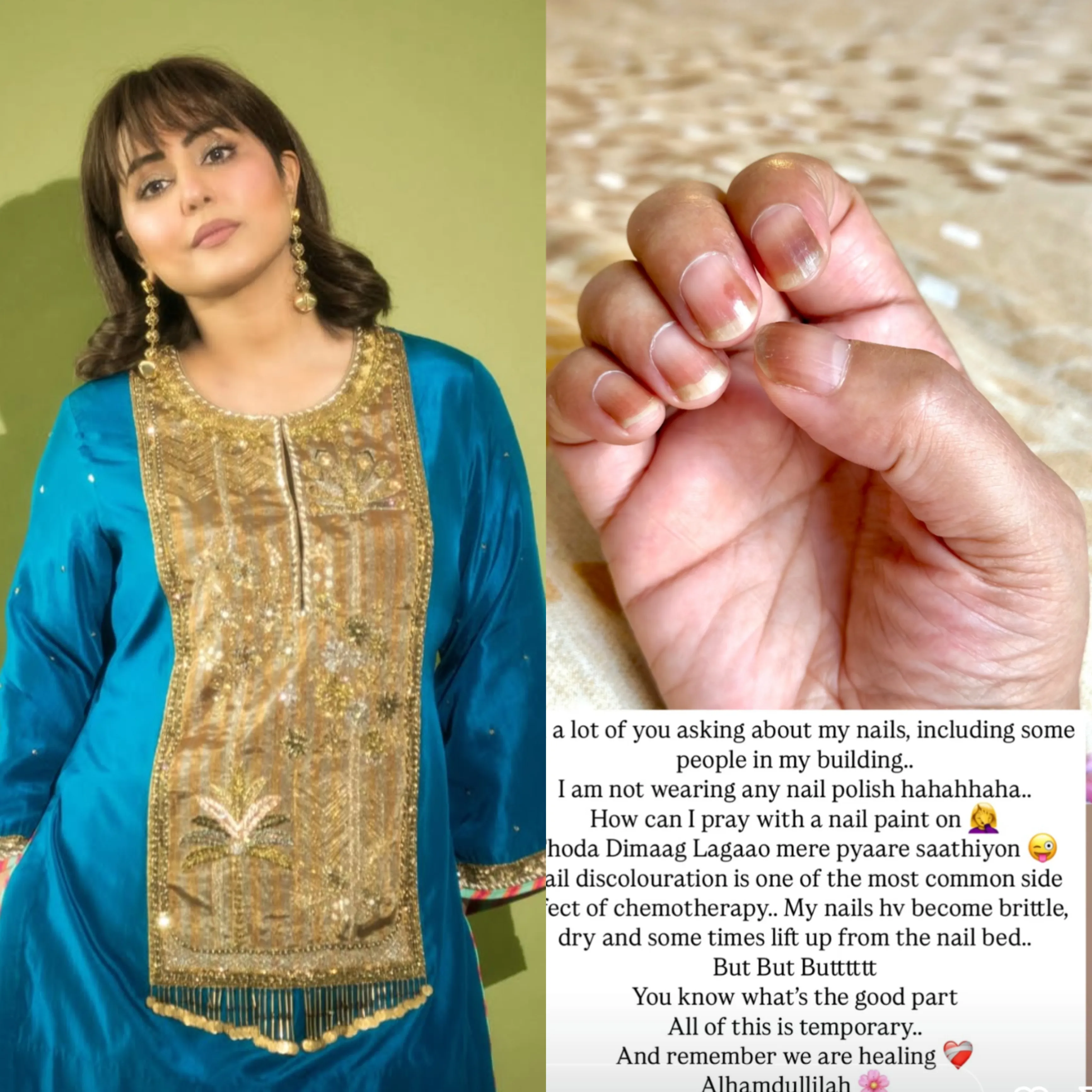 Hina Khan Unveils the Secret Behind Her Nails