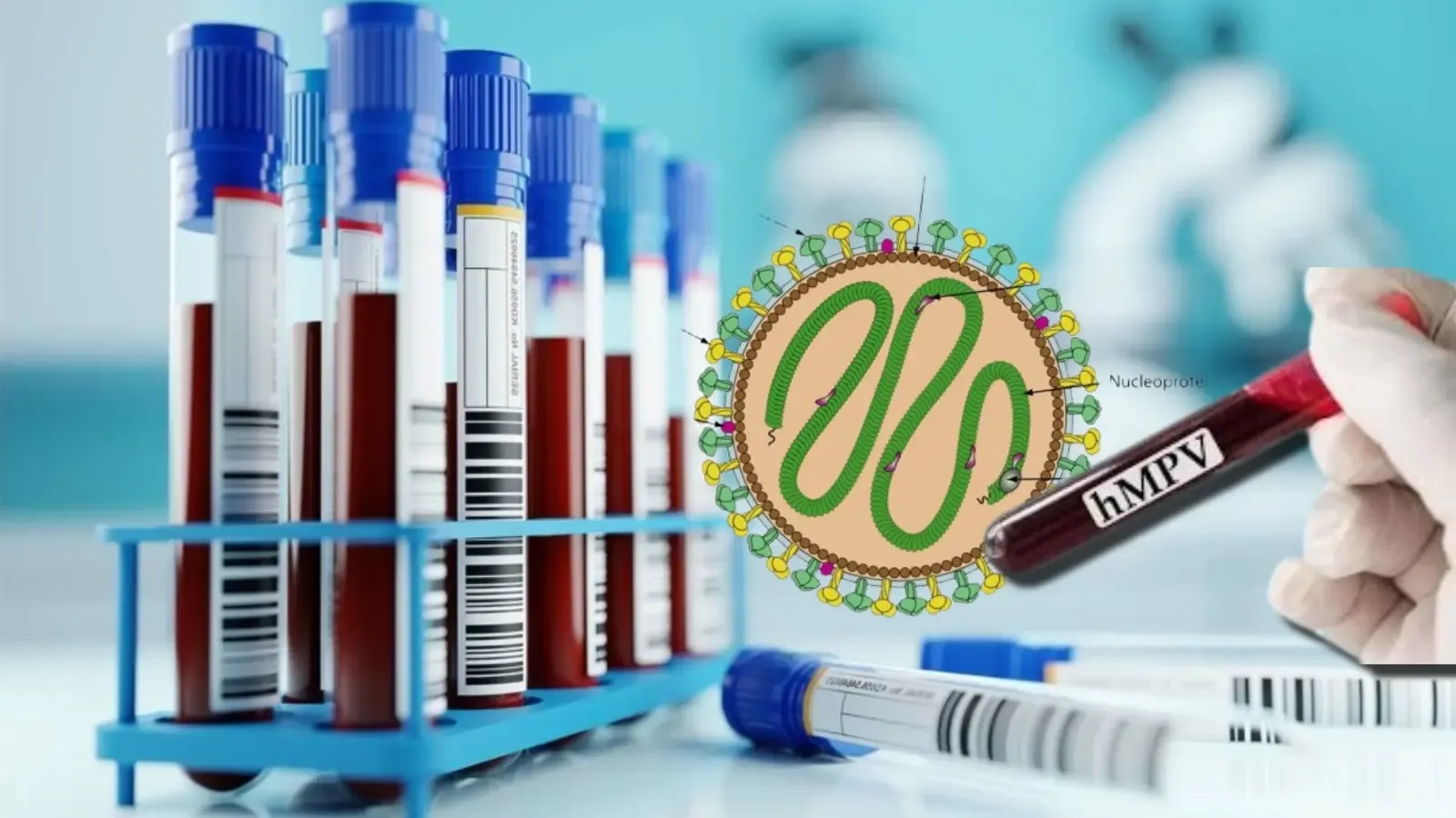 Gujarat Reports Another Human Metapneumovirus Case; Government Urges Calm