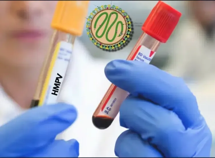 Decline in HMPV Cases Observed in Northern Regions of China