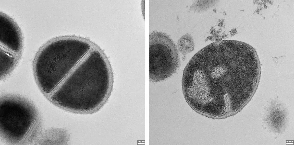 Protein Recycling System in the Human Body Acts as a Defense Against Bacteria: Research