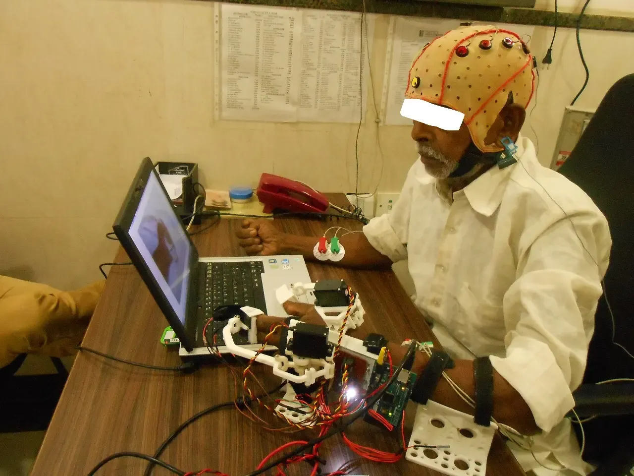 IIT Kanpur Unveils Innovative Robotic Hand Exoskeleton for Stroke Recovery