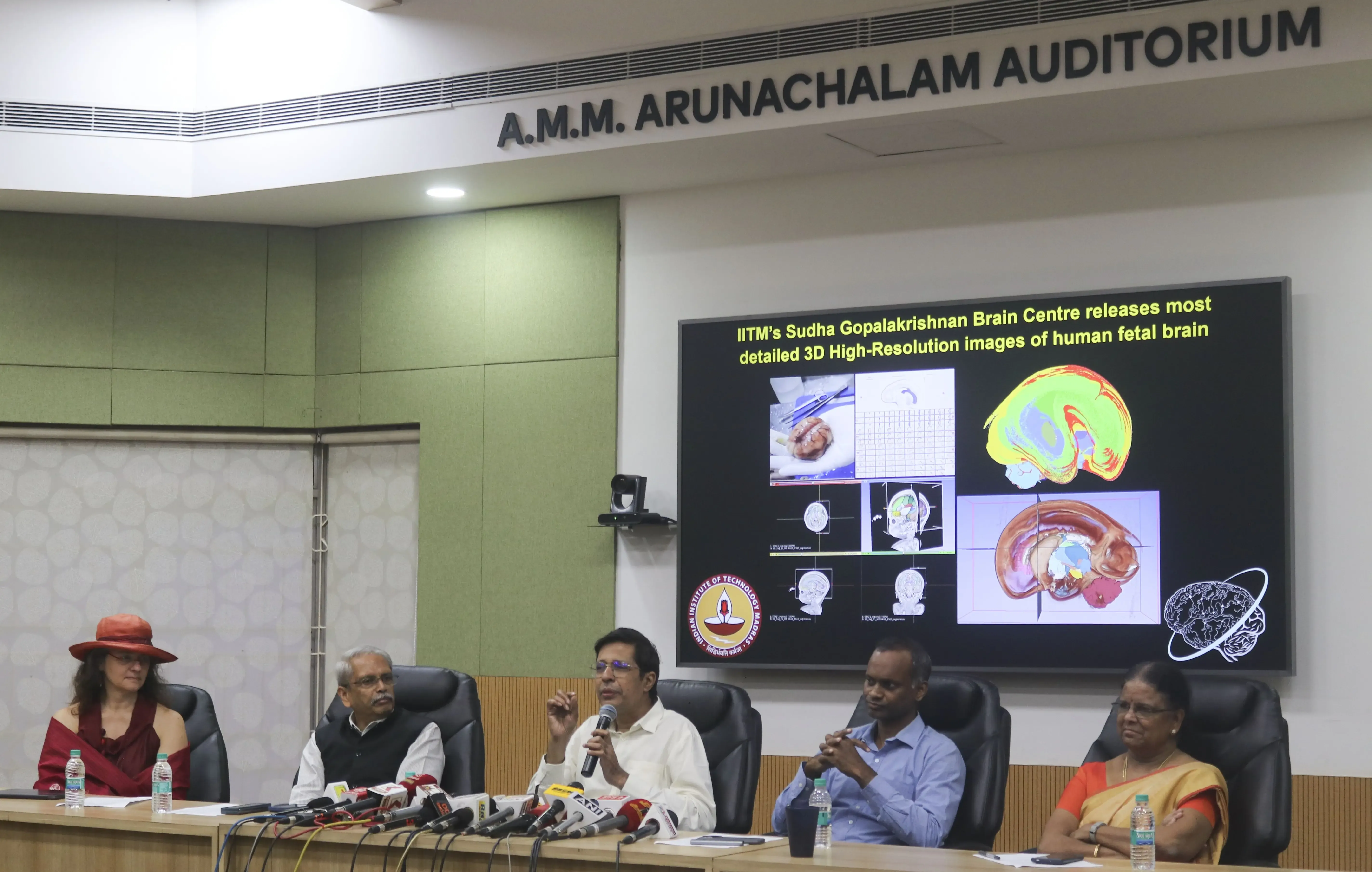 IIT Madras Unveils World's First 3D Visualizations of Human Fetal Brain