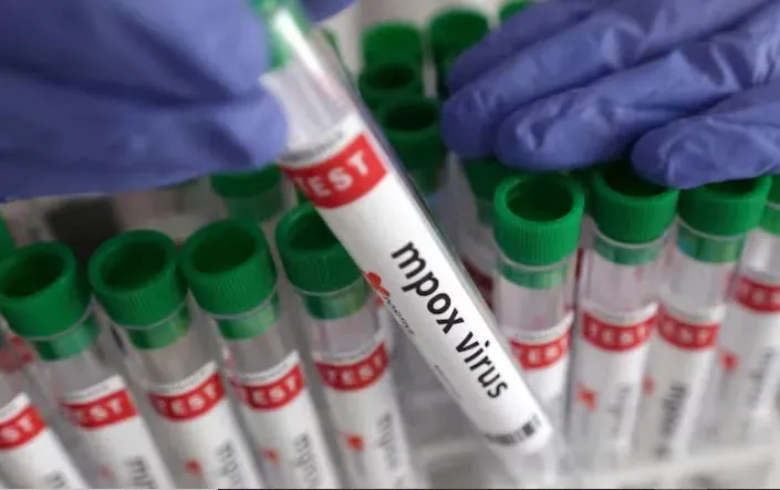 Kenya Calls for Rigorous Compliance with Mpox Prevention Strategies as Cases Surge