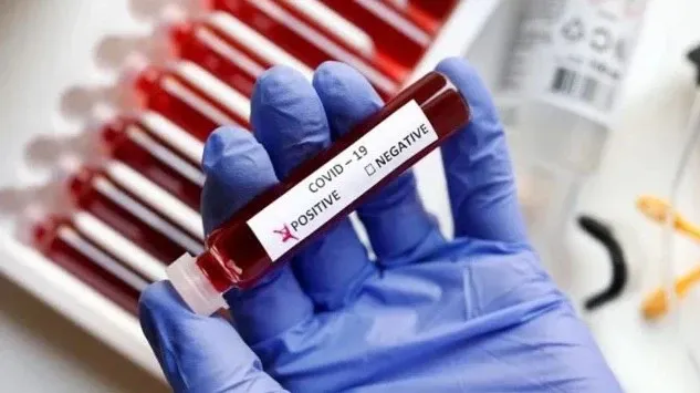Has K'taka Health Ministry Noticed a Surge in Covid Cases in Bengaluru?