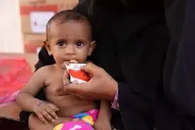 Malnutrition: A Deepening Crisis in Yemen, Says NGO