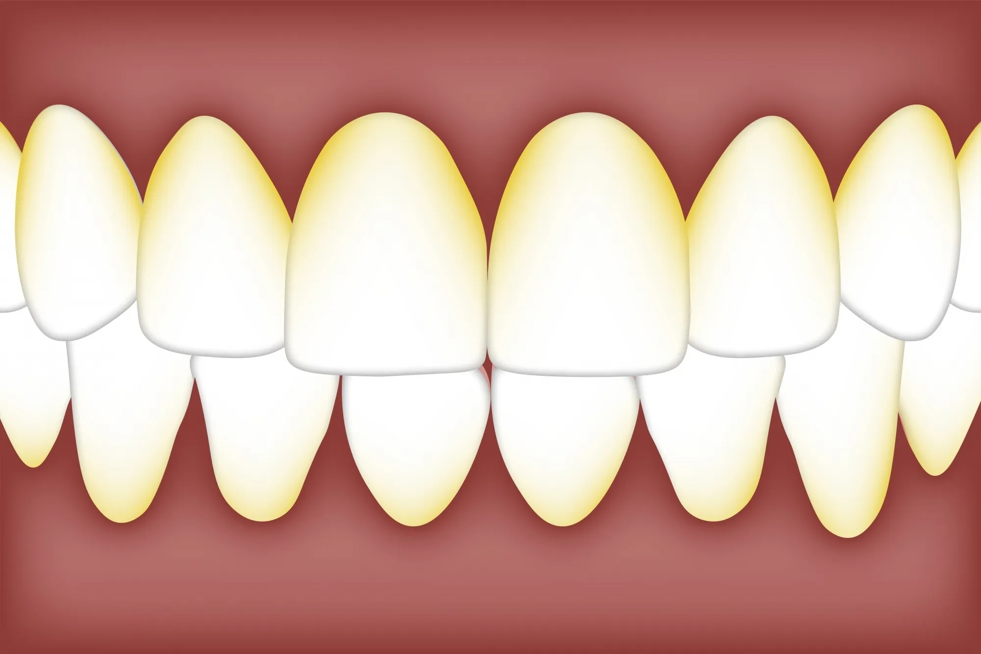 Assessing Oral Bacteria Levels to Identify Early Alzheimer’s Risk: Research Findings