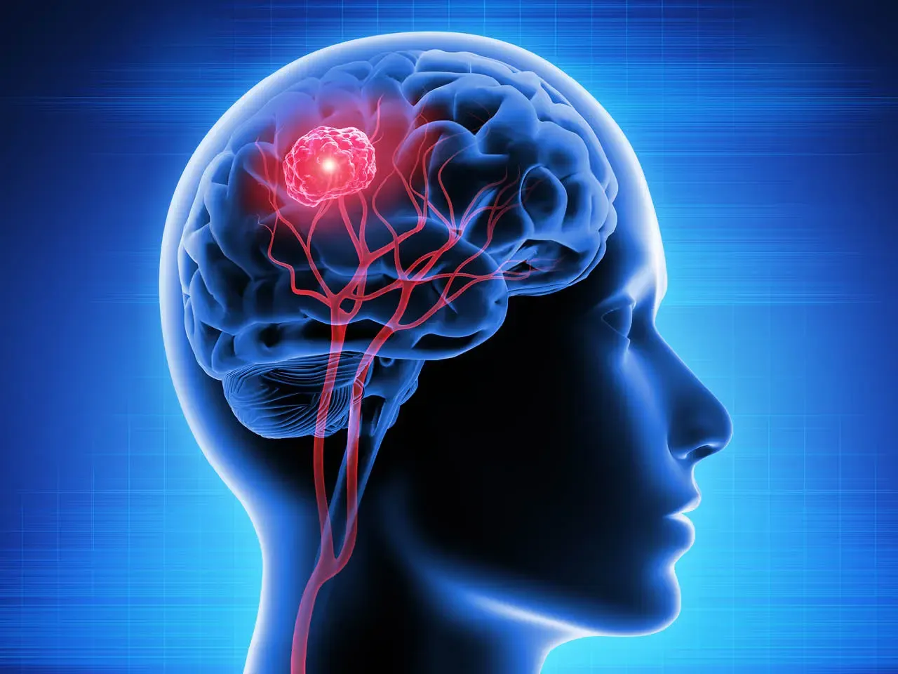 Study Reveals Men Face Triple Risk of Fatal Brain Injuries Compared to Women