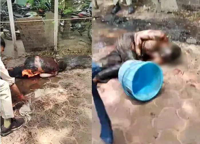 Madhya Pradesh: Man Sets Himself on Fire Outside Police Station in Bhopal, Hospitalized with Severe Burns