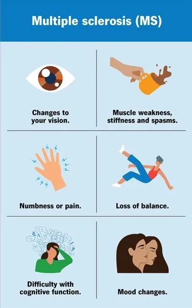 Could Multiple Sclerosis Start More Than a Decade Before Symptoms Appear?