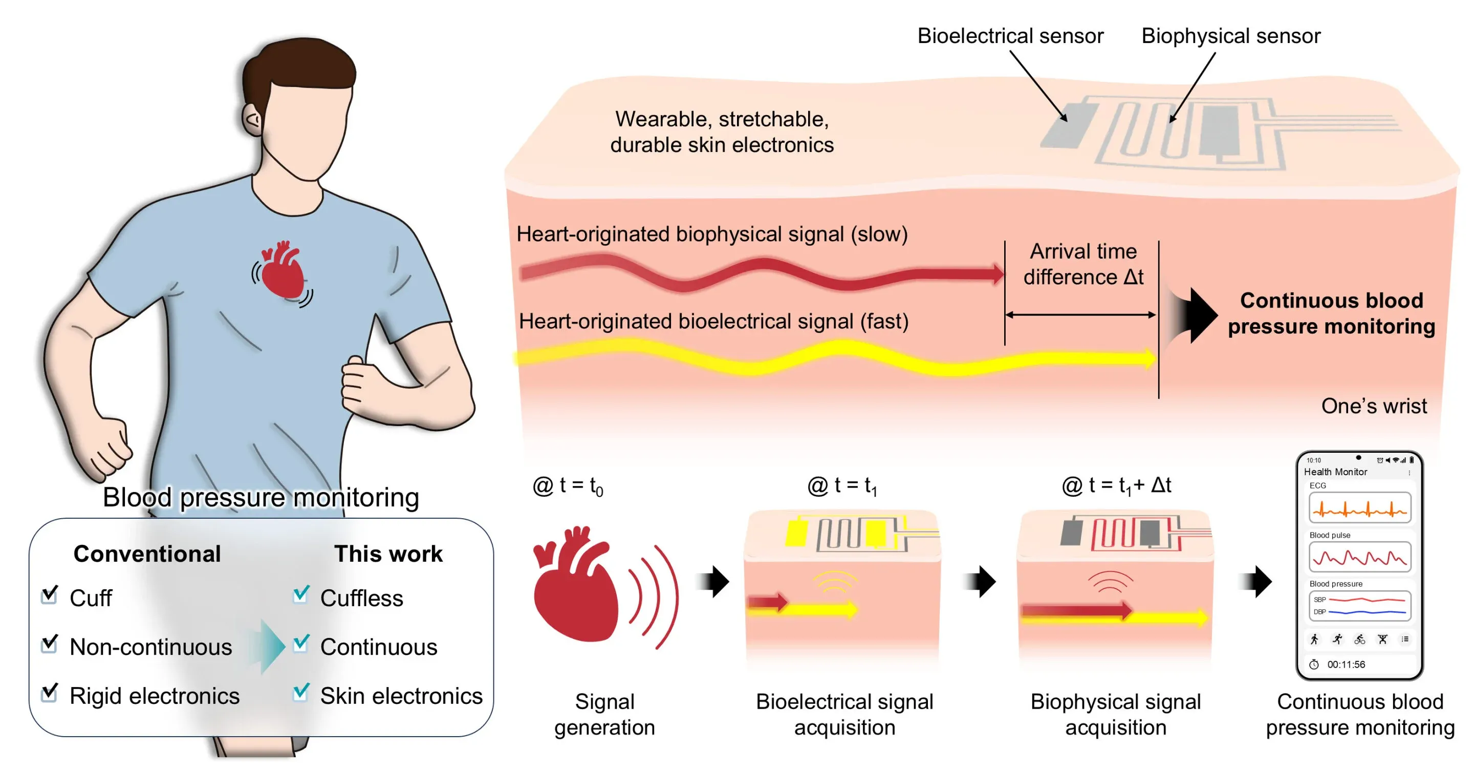 Could a New Bandage-Like Wearable Monitor Revolutionize Continuous BP Measurement?