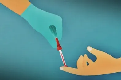 Innovative Blood Test Brings Hope for Early Parkinson's Detection