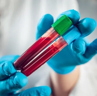 Could a New Blood Test Revolutionize Diagnosis of Rare Genetic Diseases in Children?