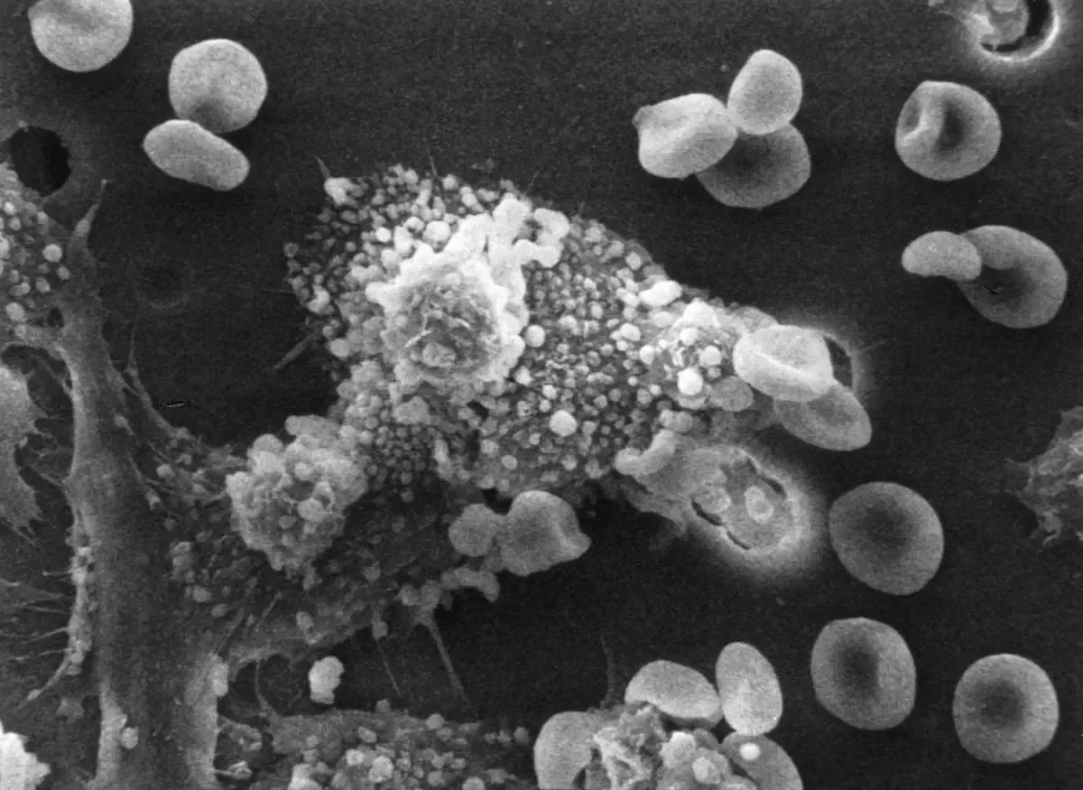 Innovative Approach Transforms Tumor-Supporting Cells into Cancer Fighters
