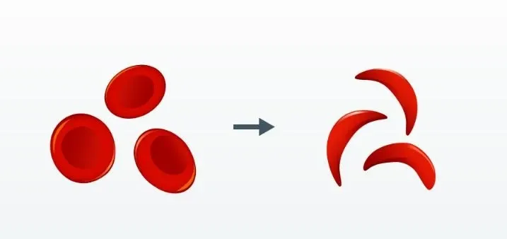 How is the Sickle Cell Elimination Mission Addressing Genetic Disorders?
