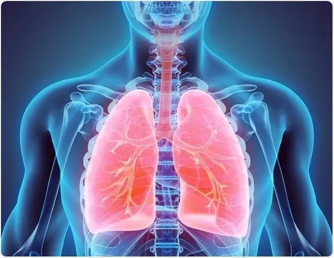 Research Reveals 1 in 3,000 Individuals at Risk of Pneumothorax Due to Genetic Mutation