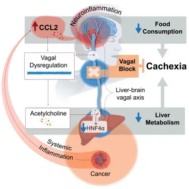What Causes the Severe Weight Loss in Cancer Patients?