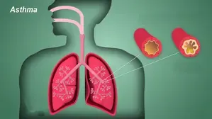 Concerns Persist Over Diagnostics and Targeted Therapies for Severe Asthma: A Report