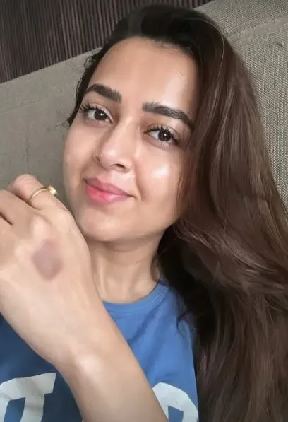 Tejasswi Prakash Injured While Filming