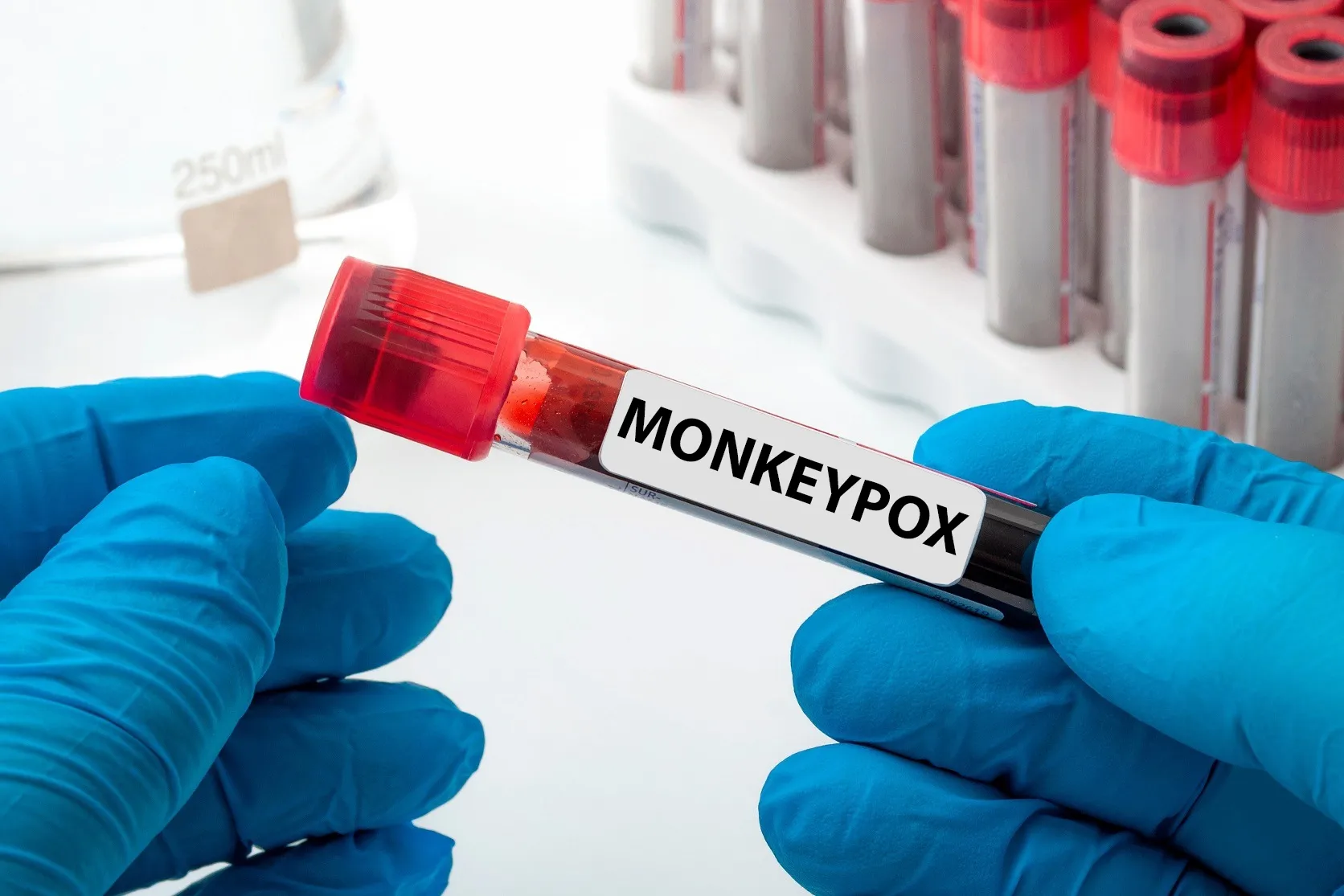 UK Discovers New Clade Ib Mpox Case, Fourth This Year
