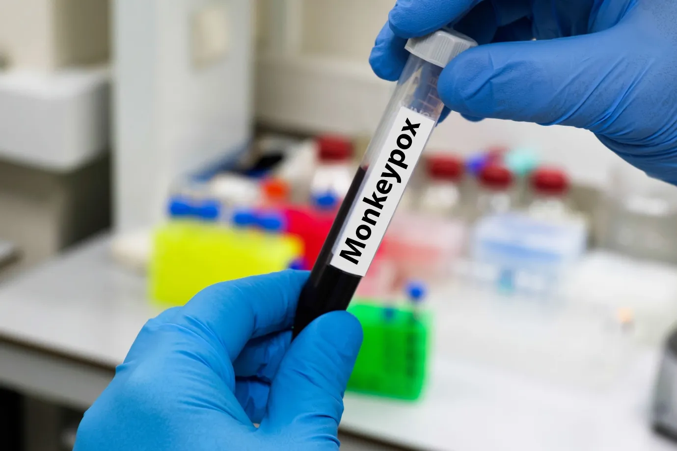 Zambia Reports Second Mortality from Mpox as Cases Surge to 49